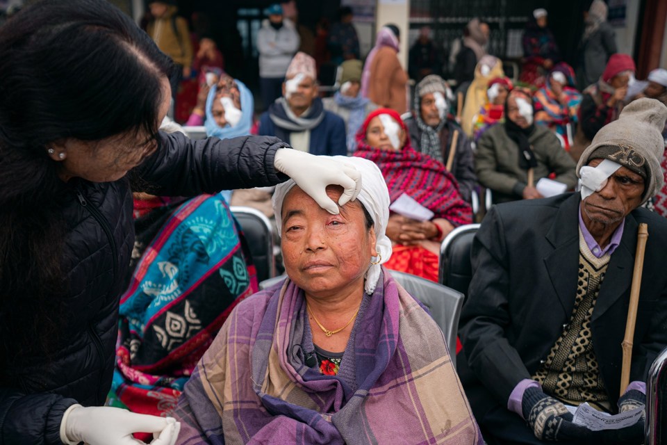 Kvinne får fjernet bandasje av øyelege, som holder øyelokket opp. 